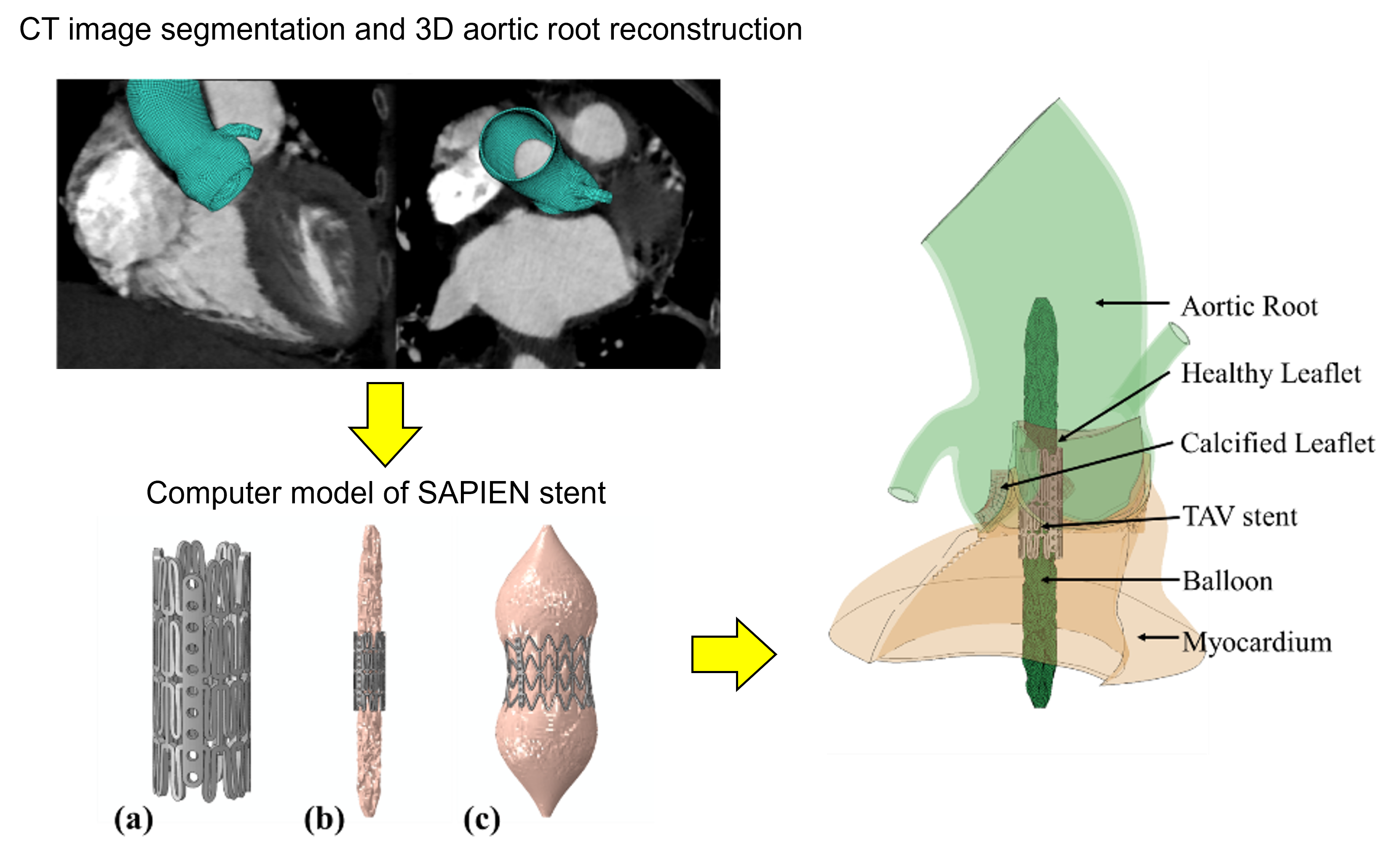TAVR patient-specific model