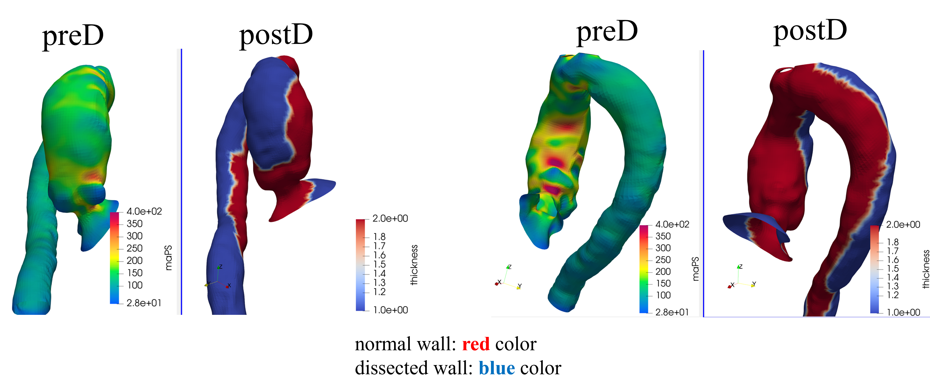Pre/post analysis — Case 2