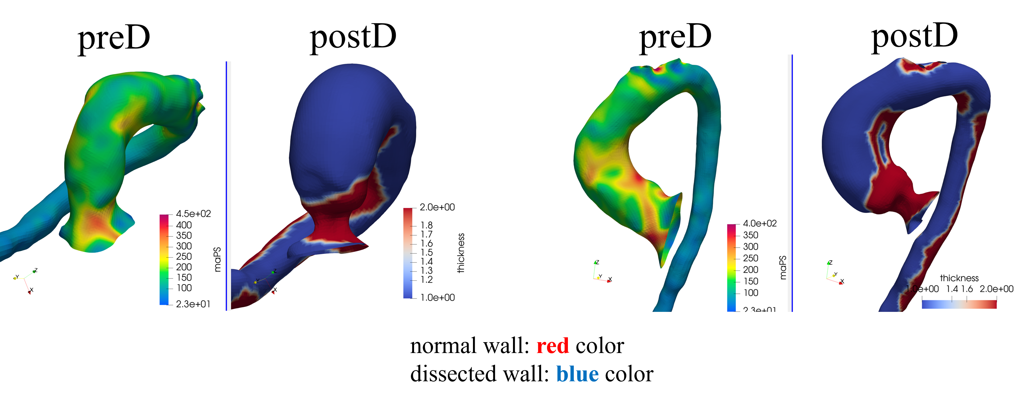 Pre/post analysis — Case 4